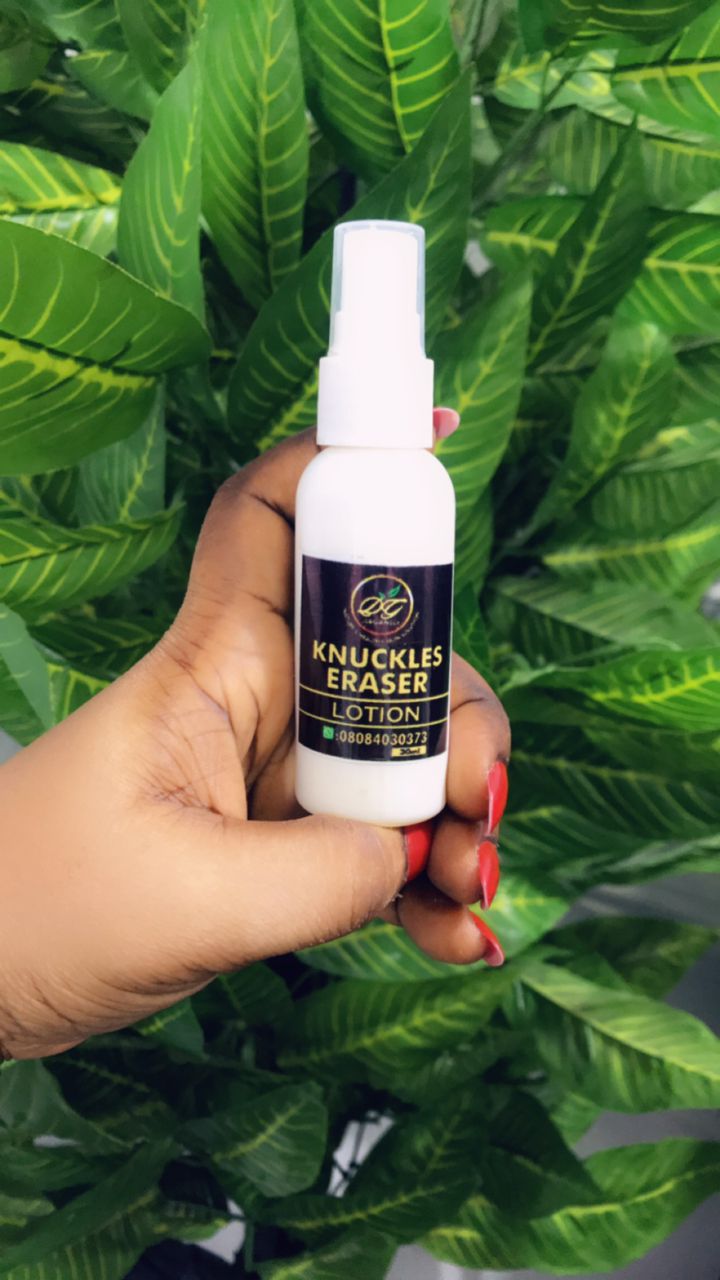 Knuckle Eraser Lotion for Dark Knuckle Removal
